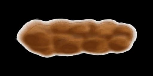 Type 2: Lumpy and sausage-shaped
